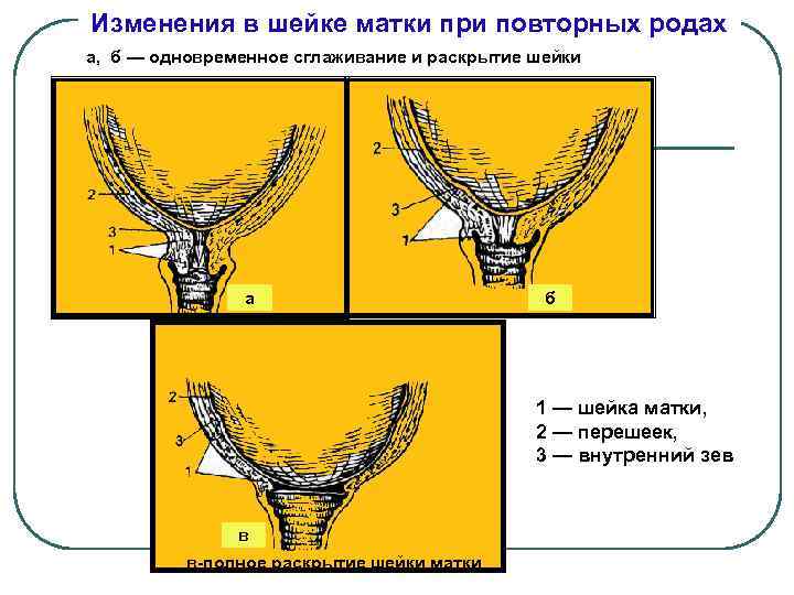 Раскрытие шейки матки. Раскрытие и сглаживание шейки матки. Изменения на шейке матки. Шейка матки при повторных родах. Сглаженная шейка матки.