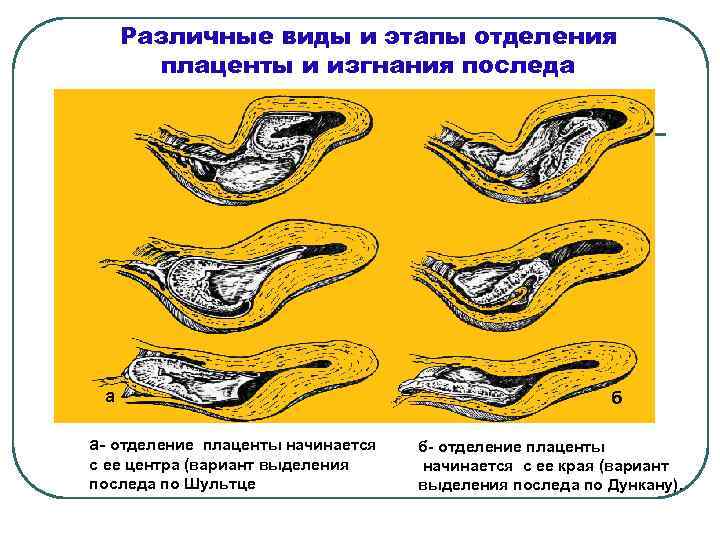 Рецепт теста для плаценты