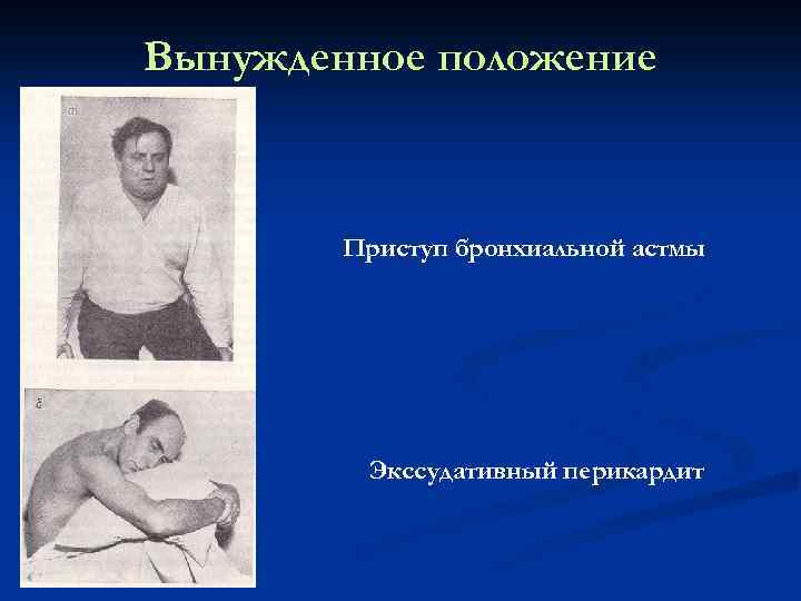 Вынужденное положение тела. Экссудативный перикардит вынужденное положение. Вынужденное положение при приступе бронхиальной астмы. Перикардит положение больного. Положение больного при выпотном перикардите.