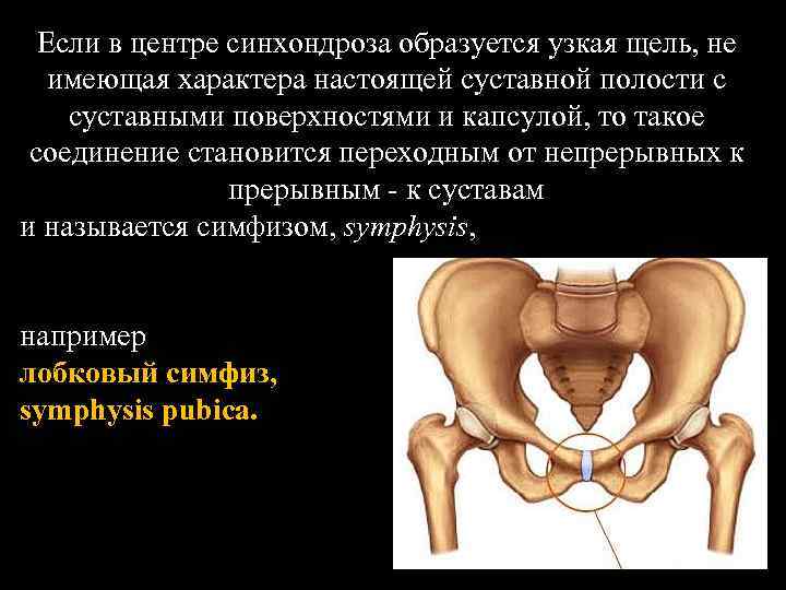Соединение лобковых костей. Лобковый симфиз это соединение. Лобковый симфиз Тип соединения. Лобковый симфиз суставные поверхности. Синхондроз тазовой кости.