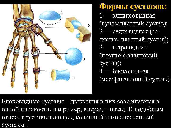 Эллипсовидная форма