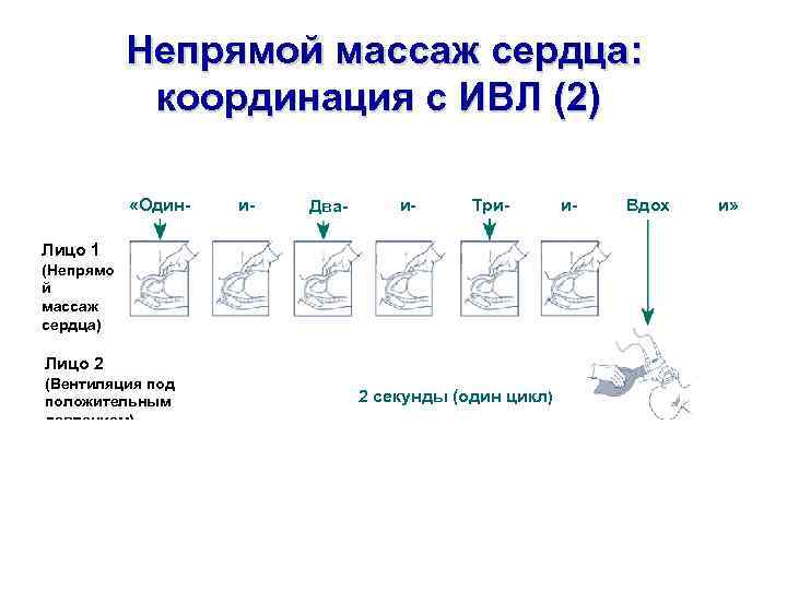 Непрямой массаж сердца: координация с ИВЛ (2) «Один- и- Два- и- Три- Лицо 1