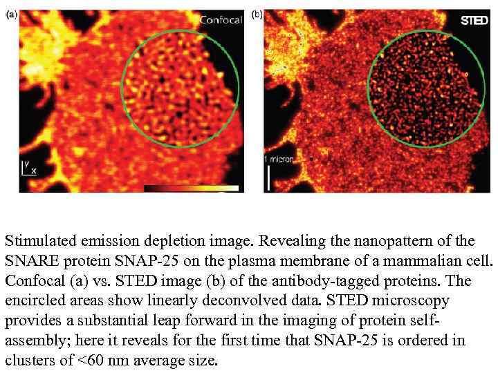 Stimulated emission depletion image. Revealing the nanopattern of the SNARE protein SNAP-25 on the