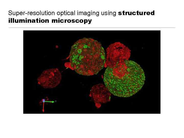 Super-resolution optical imaging using structured illumination microscopy 