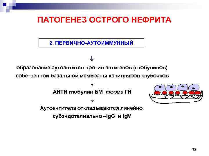 ПАТОГЕНЕЗ ОСТРОГО НЕФРИТА 2. ПЕРВИЧНО-АУТОИММУННЫЙ образование аутоантител против антигенов (глобулинов) собственной базальной мембраны капилляров