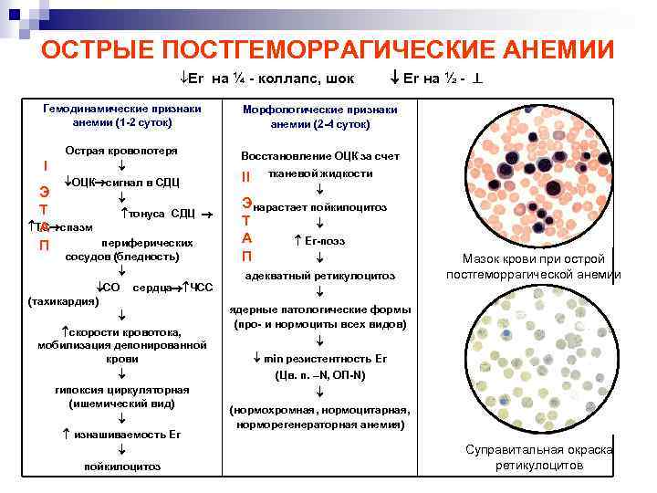 Картина крови при острой постгеморрагической анемии