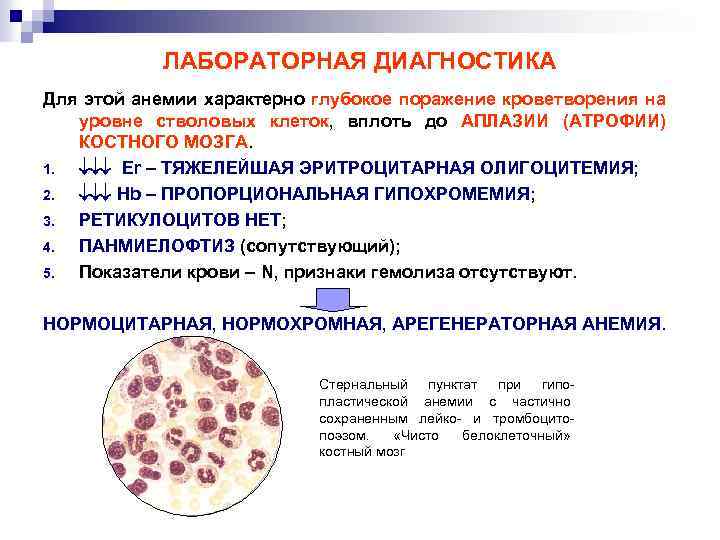ЛАБОРАТОРНАЯ ДИАГНОСТИКА Для этой анемии характерно глубокое поражение кроветворения на уровне стволовых клеток, вплоть