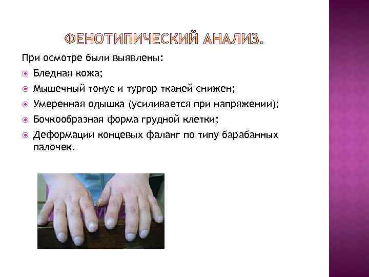 При осмотре были выявлены: Бледная кожа; Мышечный тонус и тургор тканей снижен; Умеренная одышка