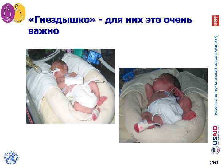 Эффективная Перинатальная Помощь и Уход (ЭПУ) «Гнездышко» - для них это очень важно 2