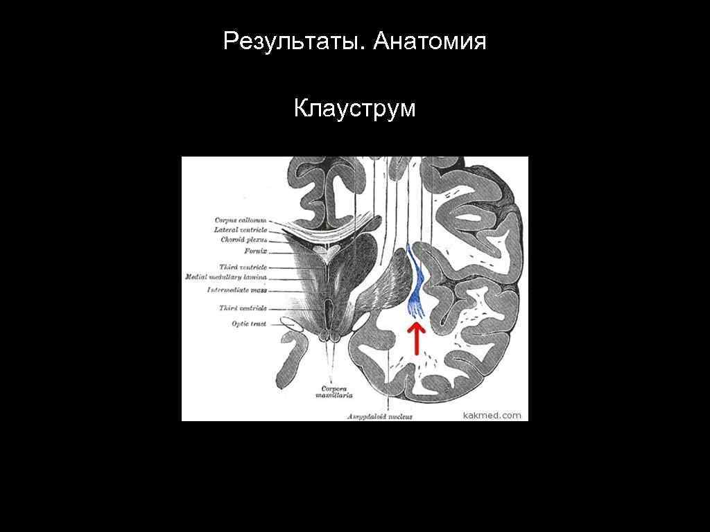 Результаты. Анатомия Клауструм 