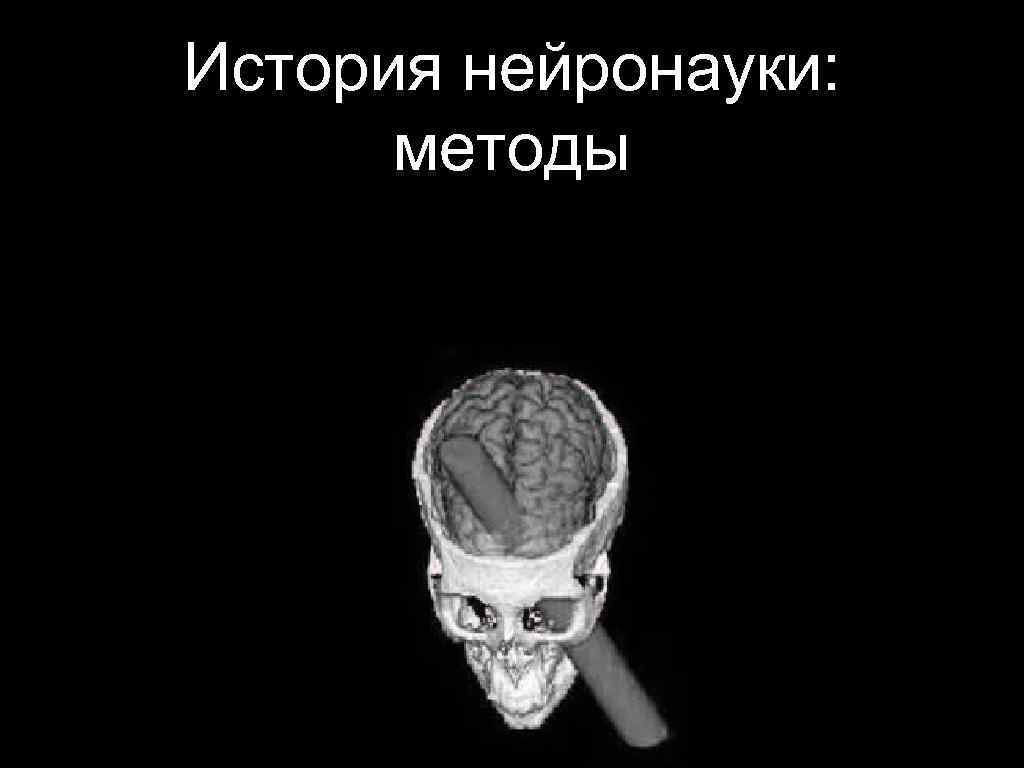 История нейронауки: методы Локальные повреждения в мозге 