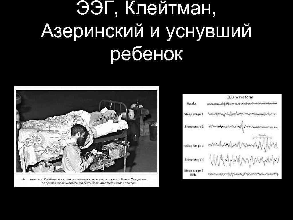 ЭЭГ, Клейтман, Азеринский и уснувший ребенок 