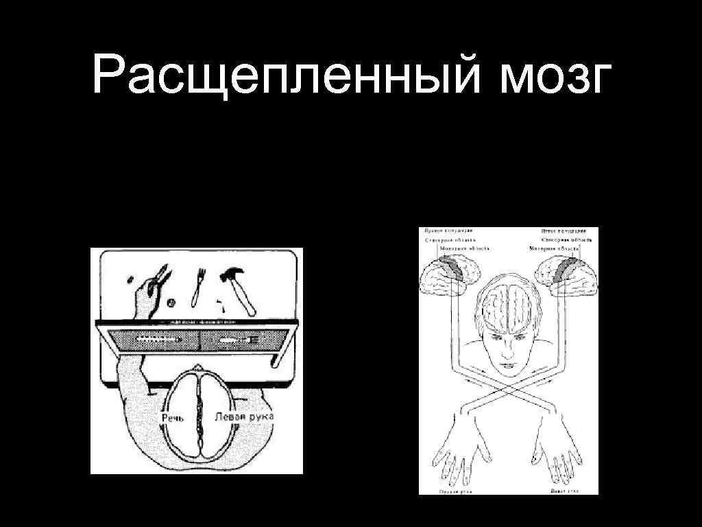 Расщепленный мозг 