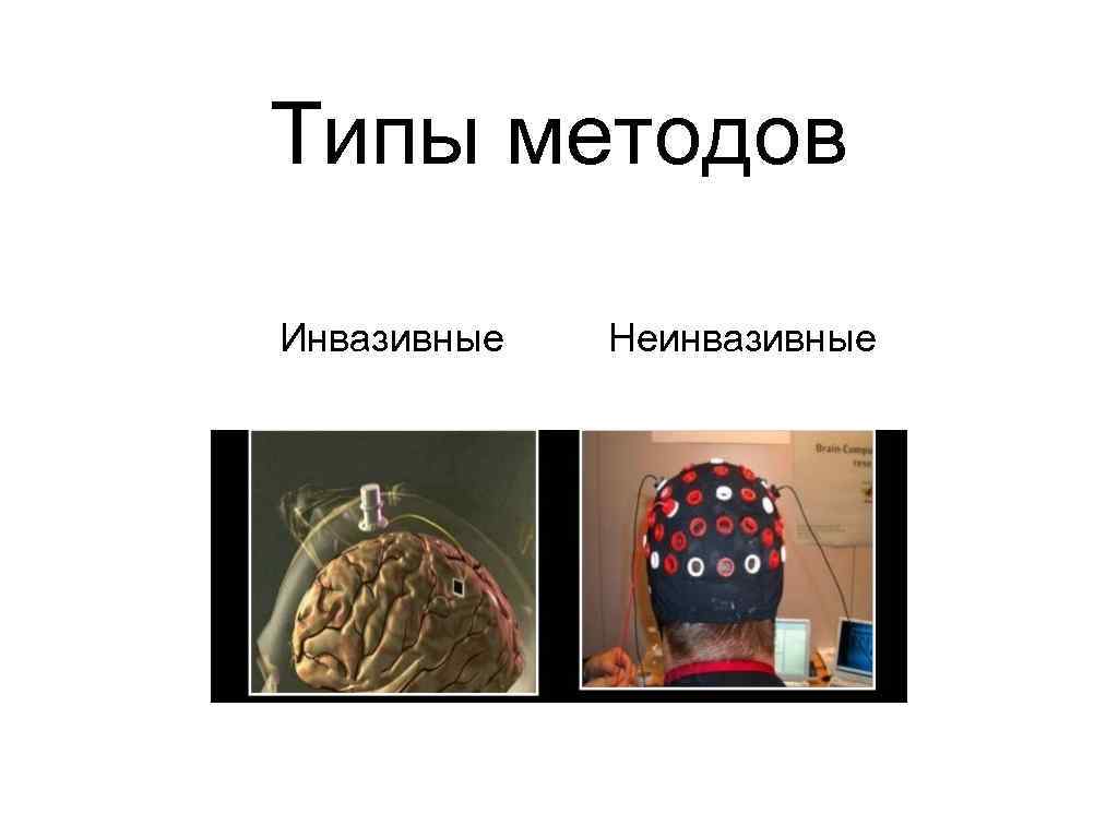 Типы методов Инвазивные Неинвазивные 
