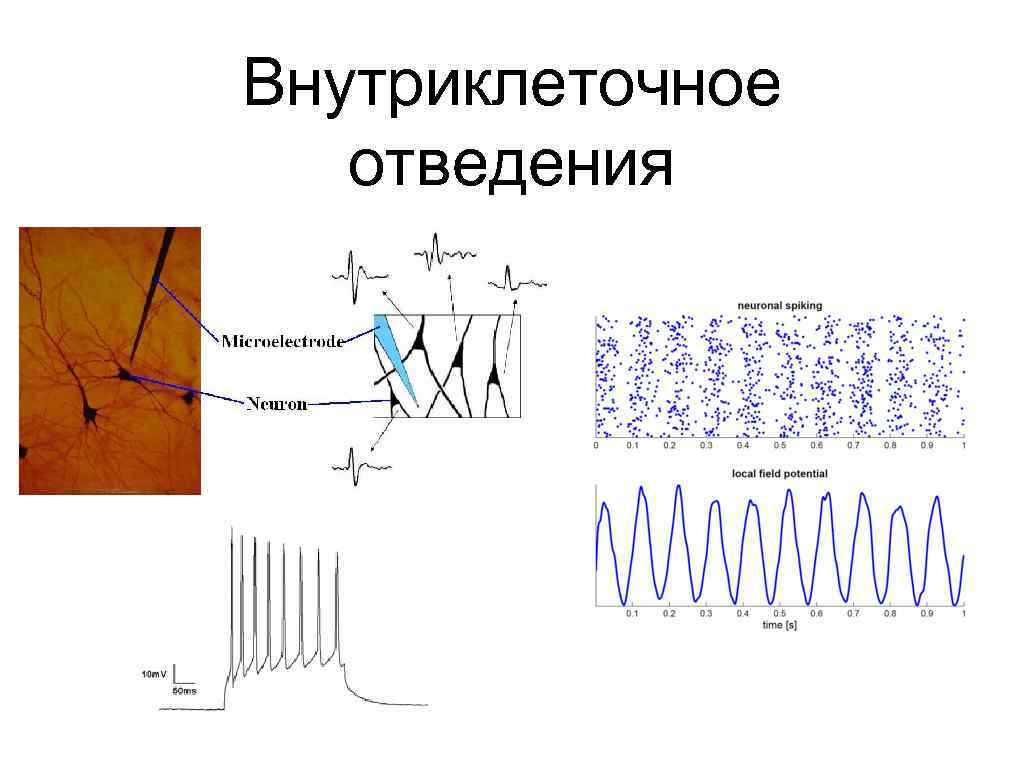 Внутриклеточное отведения 