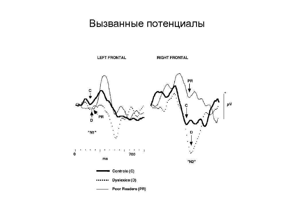 Вызванные потенциалы 
