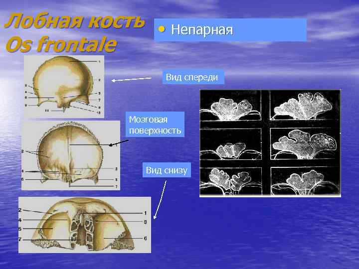 Лобная кость • Непарная Os frontale Вид спереди Мозговая поверхность Вид снизу 