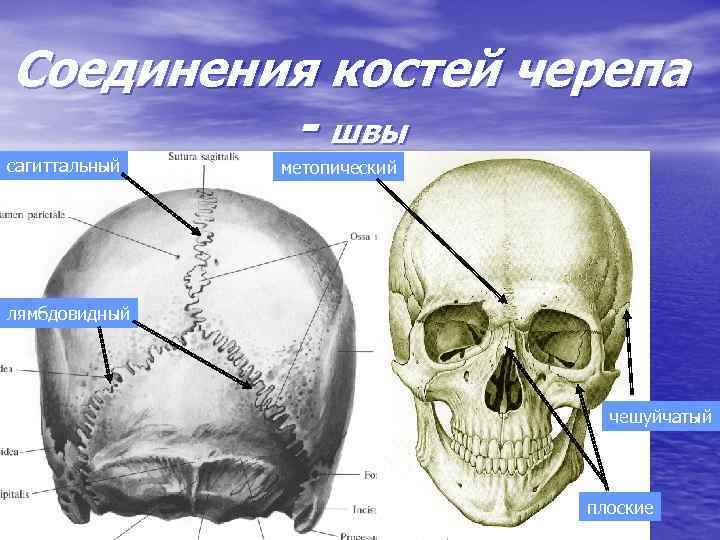 Соединения костей черепа - швы сагиттальный метопический лямбдовидный чешуйчатый плоские 