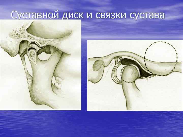 Суставной диск и связки сустава 