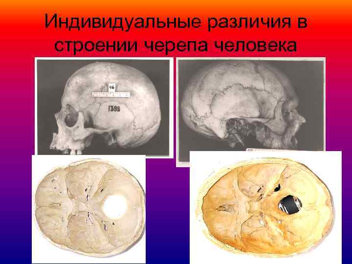 Индивидуальные различия в строении черепа человека 