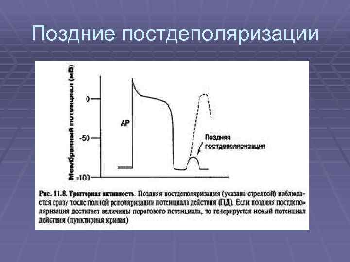 Поздние постдеполяризации 