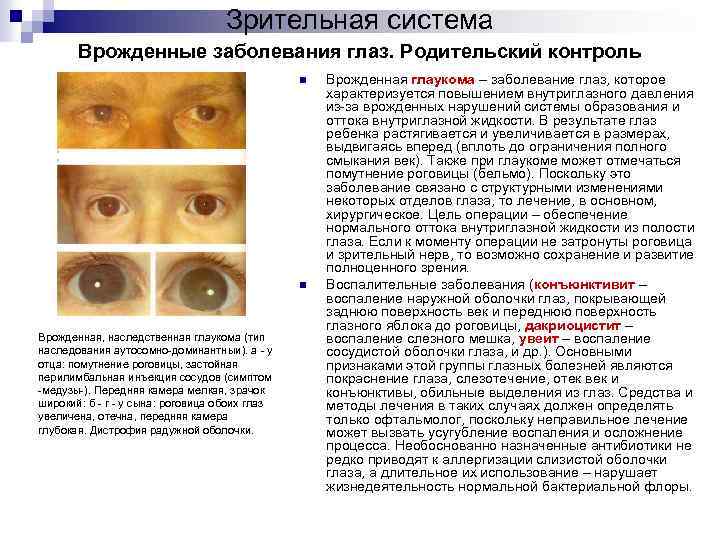 Наследственные заболевания зрения. Глаукома Тип наследования. Наследственные заболевания зрительного анализатора. Болезни глаза физиология. Физиология глаза презентация.