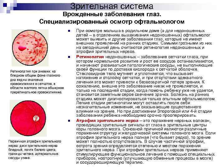 Зрительная система Врожденные заболевания глаз. Специализированный осмотр офтальмологом n n Ретинопатия при анемии: на