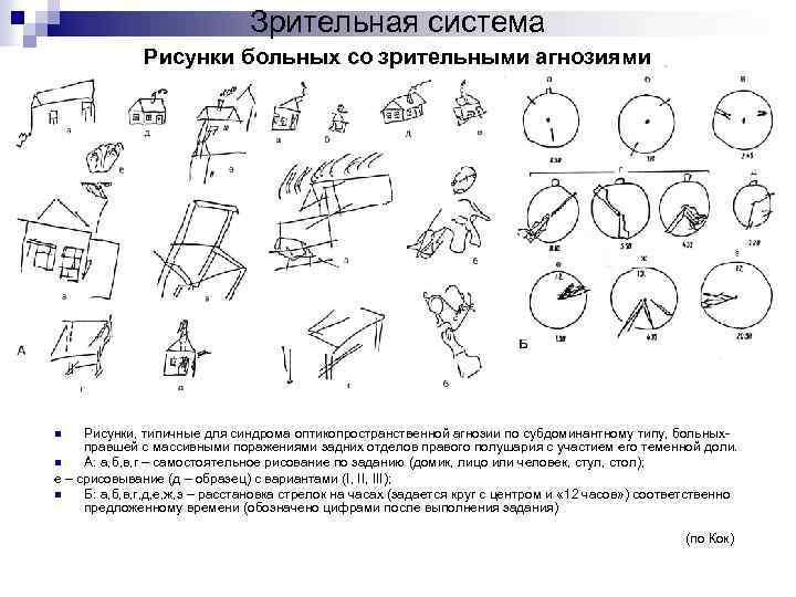 Вид агнозии характеризующийся нарушением узнавания предметов или их изображений