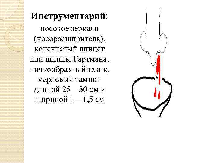 Инструментарий: носовое зеркало (носорасширитель), коленчатый пинцет или щипцы Гартмана, почкообразный тазик, марлевый тампон длиной