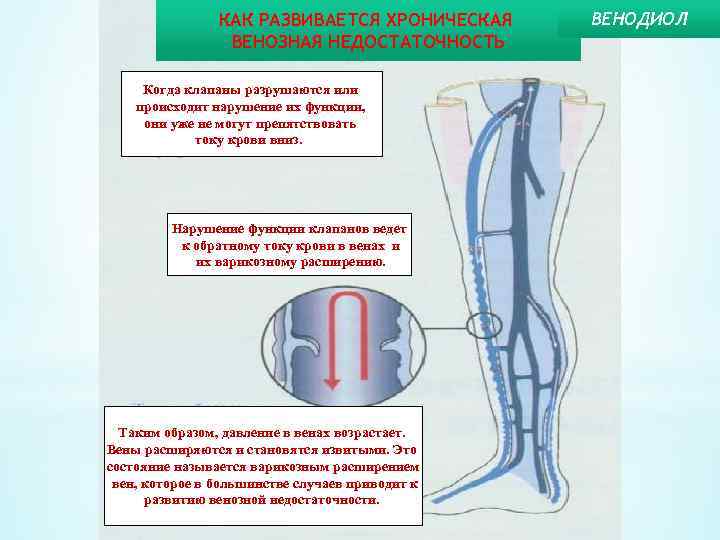 КАК РАЗВИВАЕТСЯ ХРОНИЧЕСКАЯ ВЕНОЗНАЯ НЕДОСТАТОЧНОСТЬ Когда клапаны разрушаются или происходит нарушение их функции, они
