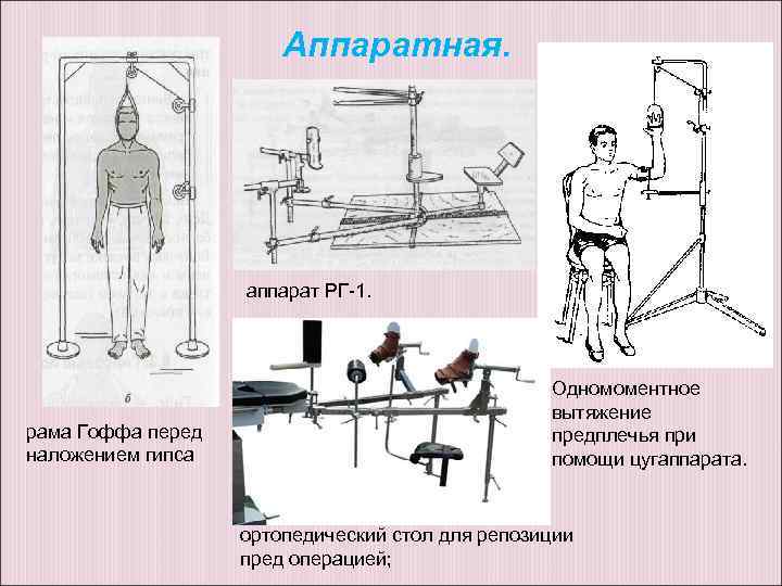 Аппаратная. аппарат РГ-1. рама Гоффа перед наложением гипса Одномоментное вытяжение предплечья при помощи цугаппарата.