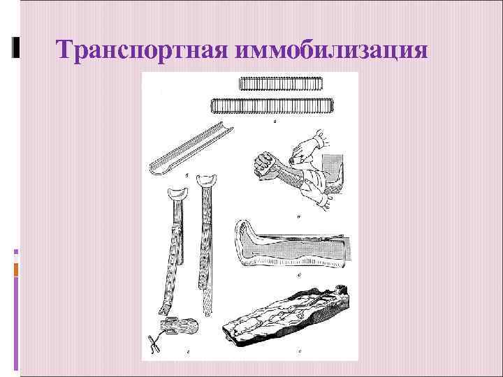 Транспортная иммобилизация 