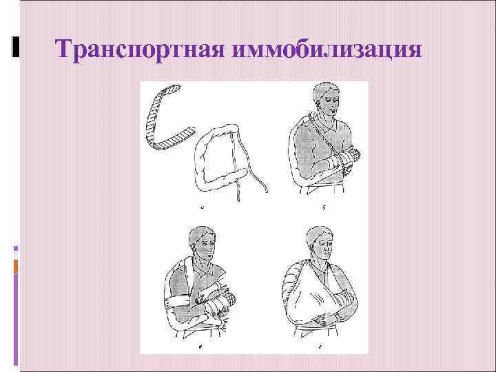Транспортная иммобилизация 