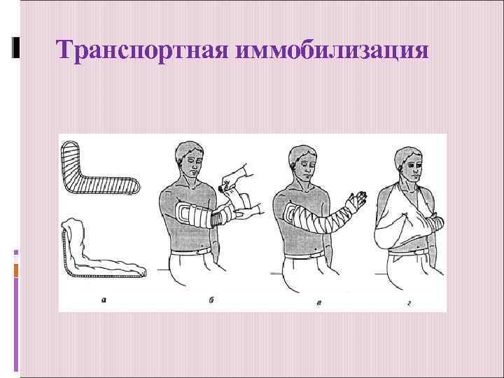 Транспортная иммобилизация 