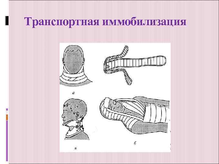 Транспортная иммобилизация 