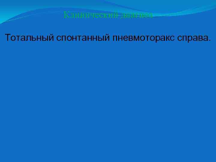 Клинический диагноз Тотальный спонтанный пневмоторакс справа. 