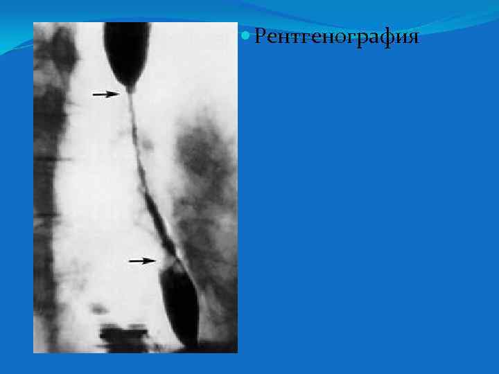 Рентгенография 
