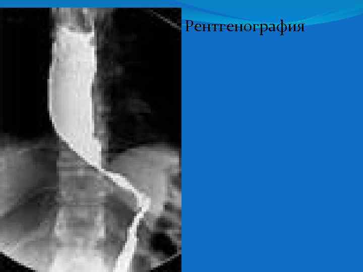  Рентгенография 