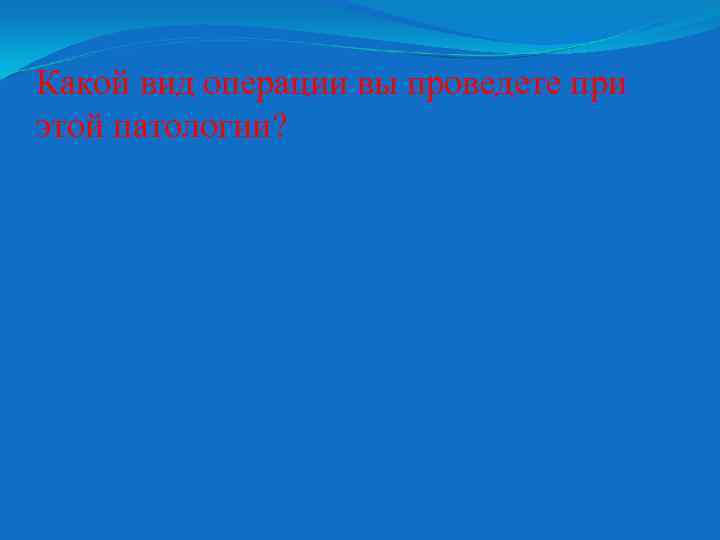 Какой вид операции вы проведете при этой патологии? 
