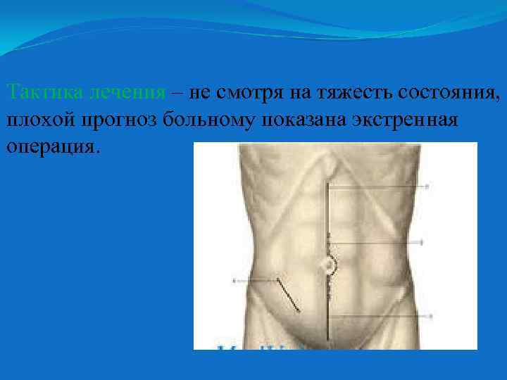 Тактика лечения – не смотря на тяжесть состояния, плохой прогноз больному показана экстренная операция.