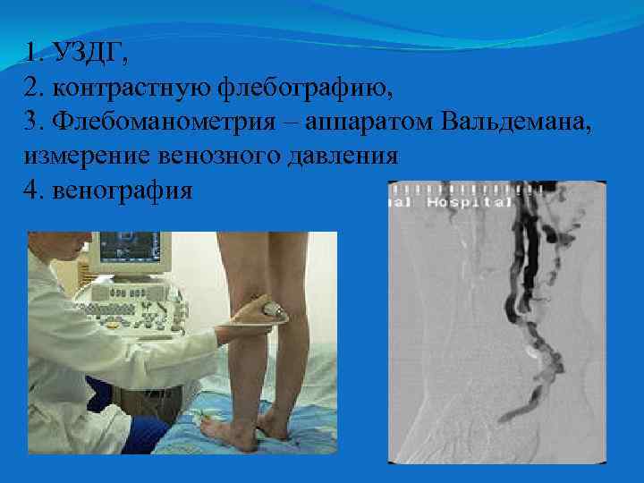 1. УЗДГ, 2. контрастную флебографию, 3. Флебоманометрия – аппаратом Вальдемана, измерение венозного давления 4.