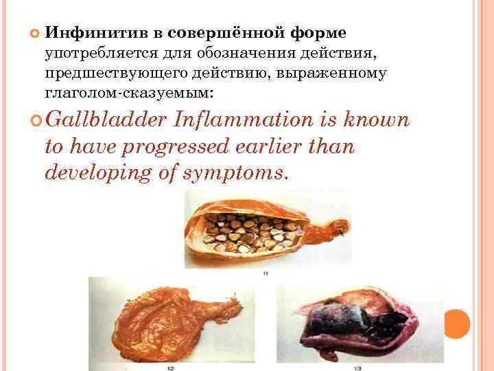  Инфинитив в совершённой форме употребляется для обозначения действия, предшествующего действию, выраженному глаголом-сказуемым: Gallbladder