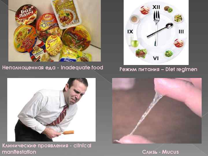 Неполноценная еда - Inadequate food Клинические проявления - clinical manifestation Режим питания – Diet