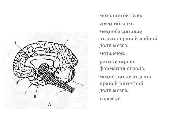 мозолистое тело, средний мозг, медиобазальные отделы правой лобной доли мозга, мозжечок, ретикулярная формация ствола,