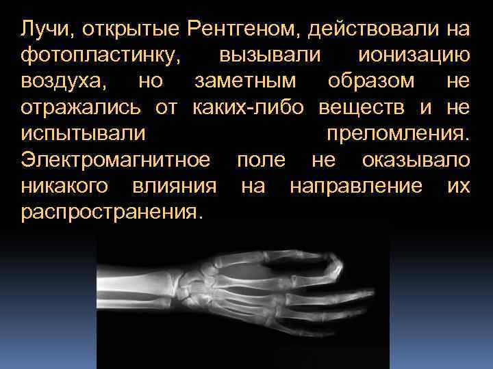 Лучи, открытые Рентгеном, действовали на фотопластинку, вызывали ионизацию воздуха, но заметным образом не отражались