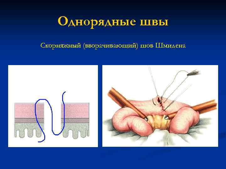 Однорядные швы Скорняжный (вворачивающий) шов Шмидена 