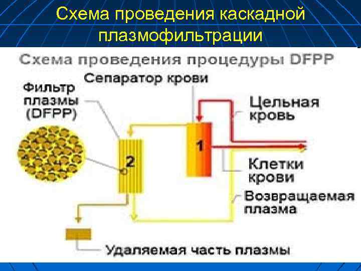 Схема проведения каскадной плазмофильтрации 