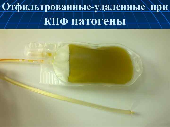 Отфильтрованные удаленные при КПФ патогены 