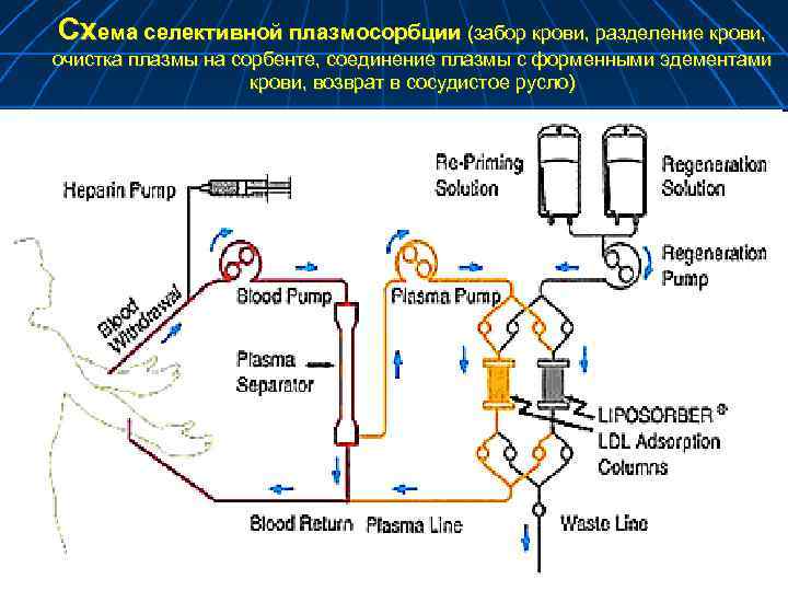 Схема селективной плазмосорбции (забор крови, разделение крови, очистка плазмы на сорбенте, соединение плазмы с