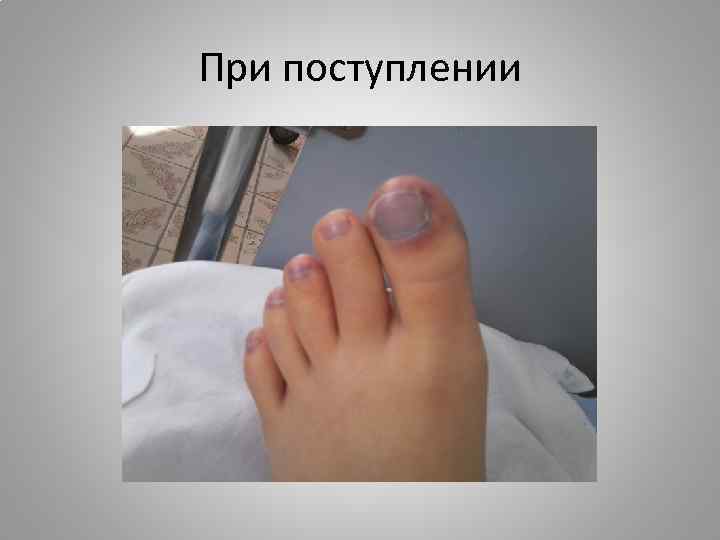 При поступлении 